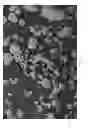 Fig. 09 - Oxidized cellulose miczrospheres including visualization agents