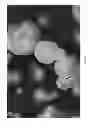 Fig. 10 - Oxidized cellulose miczrospheres including visualization agents