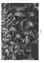Fig. 12 - Oxidized cellulose miczrospheres including visualization agents