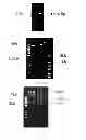 Fig. 04 - USE OF HEPATOCYTE NUCLEAR FACTOR 1A IN PREPARATION OF DRUG FOR TREATING MALIGNANT SOLID TUMOR DISEASE