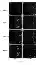 Fig. 08 - USE OF HEPATOCYTE NUCLEAR FACTOR 1A IN PREPARATION OF DRUG FOR TREATING MALIGNANT SOLID TUMOR DISEASE