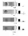 Fig. 13 - USE OF HEPATOCYTE NUCLEAR FACTOR 1A IN PREPARATION OF DRUG FOR TREATING MALIGNANT SOLID TUMOR DISEASE