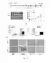 Fig. 15 - USE OF HEPATOCYTE NUCLEAR FACTOR 1A IN PREPARATION OF DRUG FOR TREATING MALIGNANT SOLID TUMOR DISEASE