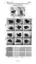Fig. 16 - USE OF HEPATOCYTE NUCLEAR FACTOR 1A IN PREPARATION OF DRUG FOR TREATING MALIGNANT SOLID TUMOR DISEASE