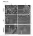 Fig. 23 - Compositions and methods for modulating EMT and uses thereof