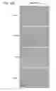 Fig. 46 - Compositions and methods for modulating EMT and uses thereof