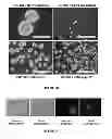 Fig. 03 - COMPOSITIONS COMPRISING SACCHARIDE BINDING MOIETIES AND METHODS FOR TARGETED THERAPY