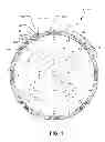 Fig. 02 - ABRASIVE ARTICLE HAVING REVERSIBLE INTERCHANGEABLE ABRASIVE SEGMENTS