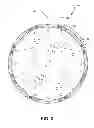 Fig. 03 - ABRASIVE ARTICLE HAVING REVERSIBLE INTERCHANGEABLE ABRASIVE SEGMENTS