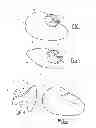 Fig. 02 - Bracket Intended to Form Part of an Orthodontic Brace and Method of Fabricating Same