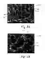 Fig. 10 - Deposition of discrete nanoparticles on an implant surface