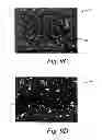 Fig. 12 - Deposition of discrete nanoparticles on an implant surface