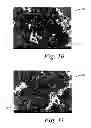 Fig. 13 - Deposition of discrete nanoparticles on an implant surface