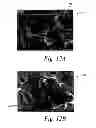 Fig. 14 - Deposition of discrete nanoparticles on an implant surface