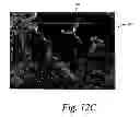 Fig. 15 - Deposition of discrete nanoparticles on an implant surface