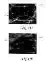 Fig. 16 - Deposition of discrete nanoparticles on an implant surface