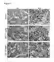 Fig. 30 - Compositions and methods for treating leukemia