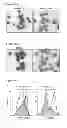 Fig. 32 - Compositions and methods for treating leukemia