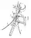 Fig. 09 - Surgical access system and related methods