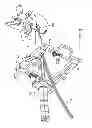 Fig. 10 - Surgical access system and related methods