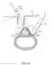 Fig. 09 - Tissue access guidewire system and method