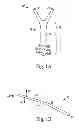 Fig. 02 - Bone fixation assembly