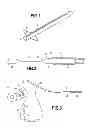 Fig. 02 - INTUBATION PROBE