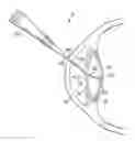 Fig. 01 - Rounded-end device, system, and method for preventing posterior capsular opacification