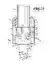 Fig. 08 - POLYAXIAL BONE SCREW WITH SHANK ARTICULATION PRESSURE INSERT AND METHOD