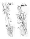 Fig. 10 - POLYAXIAL BONE SCREW WITH SHANK ARTICULATION PRESSURE INSERT AND METHOD