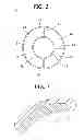 Fig. 03 - STENT