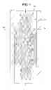 Fig. 04 - STENT