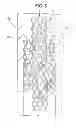 Fig. 05 - STENT