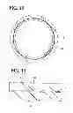 Fig. 12 - STENT