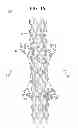 Fig. 13 - STENT