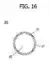 Fig. 14 - STENT
