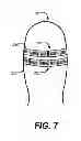 Fig. 09 - Balloon sizing device and method of positioning a prosthetic heart valve
