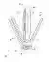 Fig. 02 - Lateral insertion spinal implant