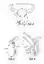 Fig. 03 - TWO FASTENER SUSPENDERS