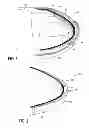 Fig. 02 - Shoe insert
