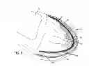 Fig. 05 - Shoe insert
