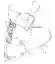 Fig. 01 - Ski/walk mechanism