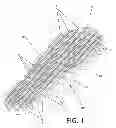 Fig. 02 - VENTILATING FOOTPAD