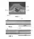 Fig. 06 - Abrasive article and method of forming