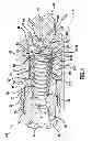 Fig. 04 - Vented pressure relief valve for an internal combustion engine fuel system