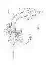 Fig. 02 - TRACHEAL TUBE WITH INNER CANNULA INDICATION SYSTEM