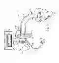 Fig. 04 - TRACHEAL TUBE WITH INNER CANNULA INDICATION SYSTEM