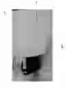 Fig. 04 - Heat retention mask and method of using the same