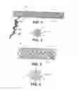 Fig. 02 - METHODS AND APPARATUS FOR OCCLUDING REPRODUCTIVE TRACTS TO EFFECT CONTRACEPTION