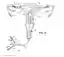 Fig. 09 - METHODS AND APPARATUS FOR OCCLUDING REPRODUCTIVE TRACTS TO EFFECT CONTRACEPTION